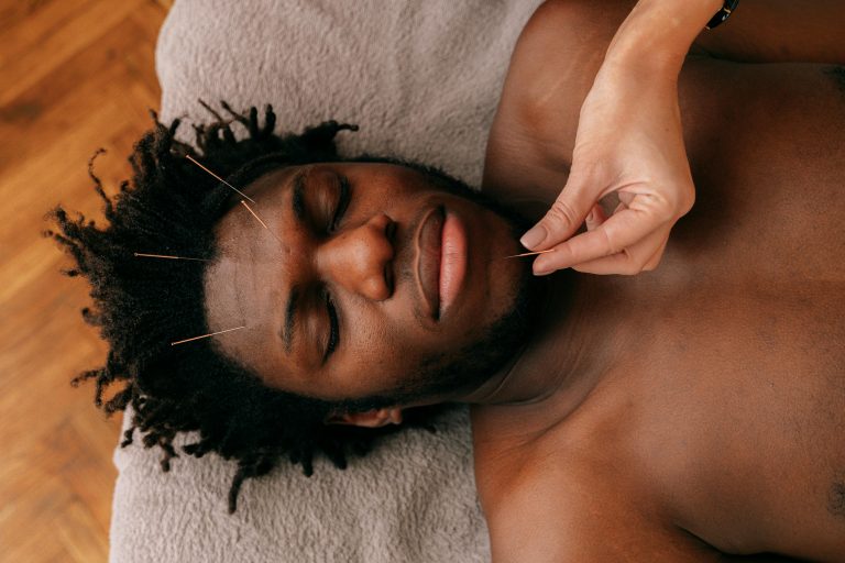 Acupuntura dental: ¿Qué es y cuáles son sus beneficios?